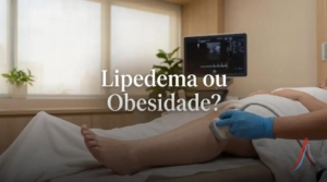 Cirurgião vascular em Santo André;Angiologista no ABC Paulista;Tratamento de varizes a laser em Santo André;Clínica vascular Bairro Jardim Santo André;Ultrassom com Doppler vascular ABC;Consulta com cirurgião vascular particular;Vascular perto do Parque Celso Daniel;Angiologista próximo à Rua das Figueiras;Cirurgião vascular Alameda São Caetano;Médico vascular perto do Grand Plaza Shopping;Tratamento de varizes perto de São Caetano do Sul;Clínica vascular próximo ao Shopping ABC;Angiologista Bairro Campestre e Jardim;Médico especialista em lipedema no ABC;Tratamento para lipedema cirurgia e clínico;Diferença entre lipedema e celulite;Gordura nas pernas que não sai com dieta;Dor ao toque nas pernas lipedema;Tratamento de linfedema em Santo André;Drenagem linfática especializada e terapia compressiva;Diagnóstico de lipedema com ultrassom;Inchaço crônico nas pernas o que fazer;Lipedema nos braços e pernas sintomas;Cirurgia de varizes a laser recuperação;Tratamento de varizes minimamente invasivo;Laser endovenoso para varizes;Escleroterapia com espuma;Tratamento avançado de feridas e úlceras;Pernas inchadas e pesadas causas;Como tratar pé diabético;Ferida na perna que não cicatriza;Sintomas de má circulação nas pernas;Dor nas pernas e cansaço excessivo;feridas;diabetes;pé diabético;lipedema ou obesidade